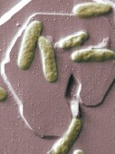 Bacterial Infection's Spread Occurs Beyond Health Care Settings: Study