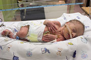 Preemies' Woes Sometimes Due to Heredity, Study Says