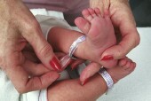 Researchers Describe 1st 'Functional Cure' of HIV in Baby