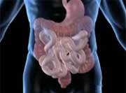 Crohn's and Colitis May Be Tied to Risk of Heart Attack, Stroke