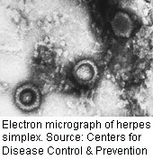Scientists Say Pressure Allows Herpes Viruses to Infect Cells