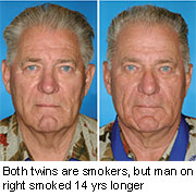 Study of Twins Shows How Smoking Ages the Face