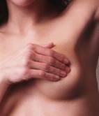 Bigger Breasts, Lack of Exercise Tied to Breast Cancer Mortality