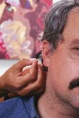 Ear Acupuncture May Hold Promise for Weight Loss