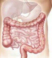 Age-Related Colon Condition Not Cause for Alarm, Study Says
