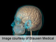 Amnesia Patient's Brain Helps Illuminate How Memory Works