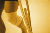Hormone Therapy May Cut Risk of Repeat Joint Replacement Surgery in Women