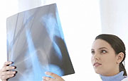 Radiation Before Surgery May Improve Survival From Rare Lung Cancer