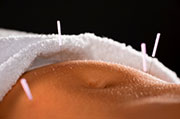 Making Acupuncture Even Safer