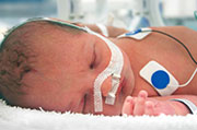 Preemie Breathing Problems Might Linger in Adulthood