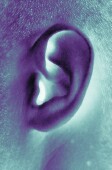 NIH Launches 'Nerve Stimulation' Trial to Ease Tinnitus