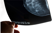 Fertility Drugs May Not Raise Breast Cancer Risk: Study