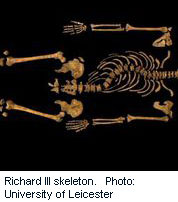 Richard III's Curved Spine Had Little Impact on His Mobility: Study