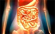 Gut Microbes Differ in Obese or Diabetic People, Study Finds