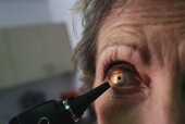 Eye Tests Might Help ID Alzheimer's, Studies Suggest
