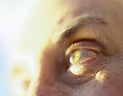Scientists Use Stem Cells to Grow Human Corneas in Mice