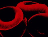 Mutations Linked to Blood Cancers Rise With Age, Study Shows