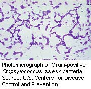 Older Antibiotic Still Works Against Staph Infections, Study Finds