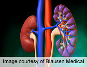 Drug Combo Helps Lupus-Related Kidney Condition