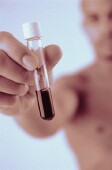FDA Approves Blood Test That Gauges Heart Attack Risk