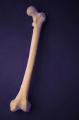 Stronger Muscles = Healthier Bones in Kids