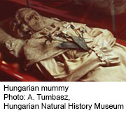 18th Century Mummies Reveal How TB Spread Through Europe
