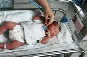 More Babies Born to Mothers Addicted to Pain Meds